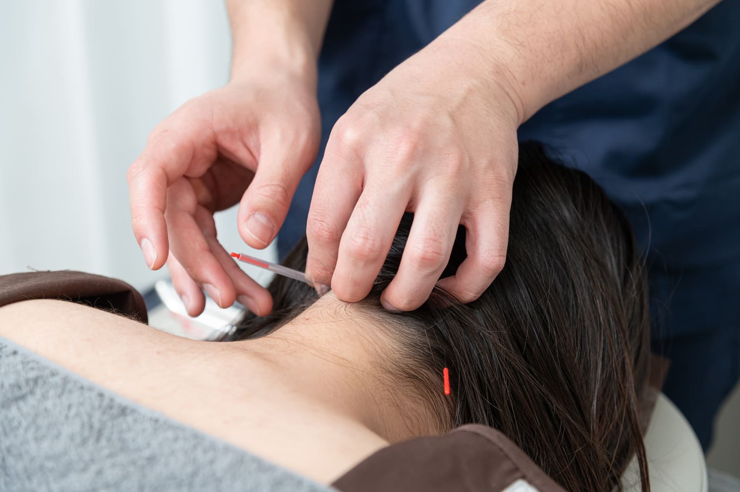 パニック障害に鍼灸は効果がある？自律神経への作用とエビデンス